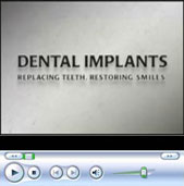 Watch Dental Implants Video